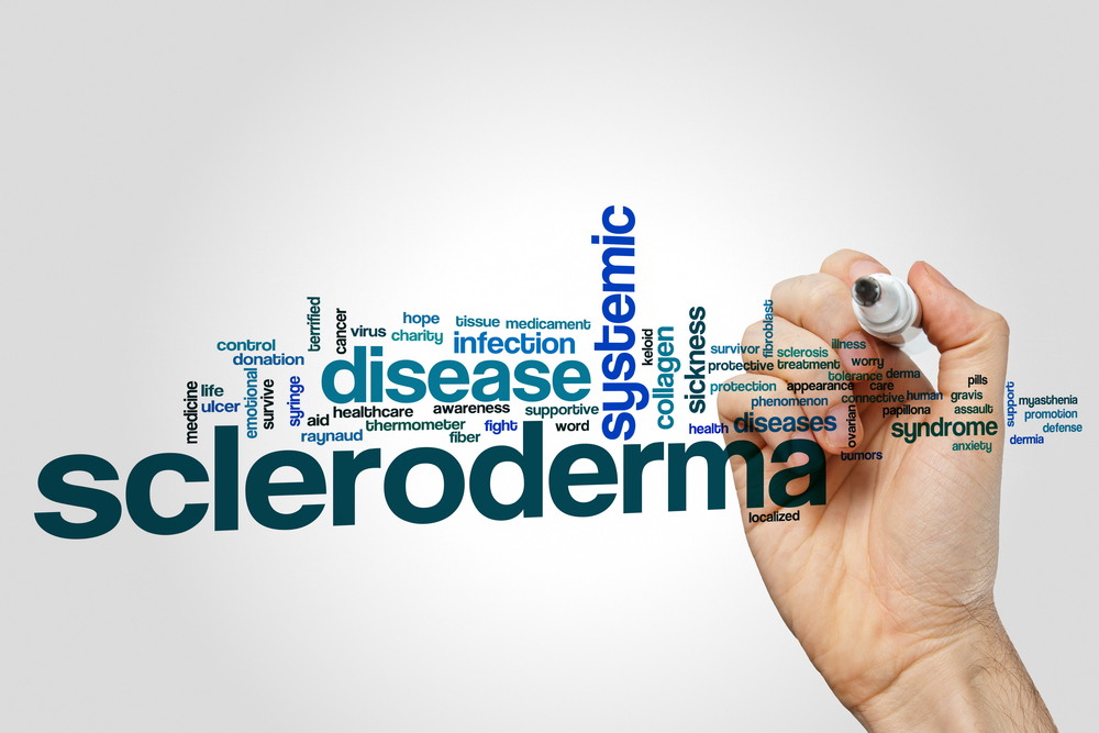 Scleroderma Ayurvedic Herbal Treatment