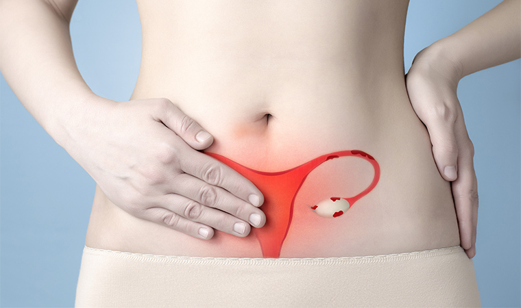 Endometriosis Natural Ayurvedic Treatment