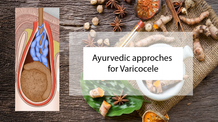 Varicocele Ayurvedic Naturopathic Herbal Treatment