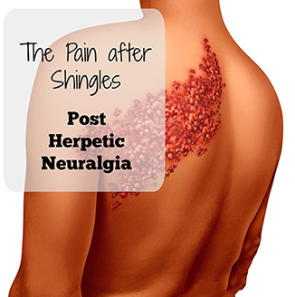 Post herpetic neuralgia PHN Ayurvedic Herbal Treatment